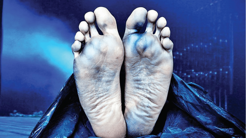 Ý nghĩa những giấc mơ thấy xác chết thường gặp khác